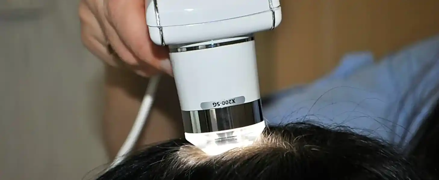 Консультация трихолога с компьютерной диагностикой со скидкой 30% 