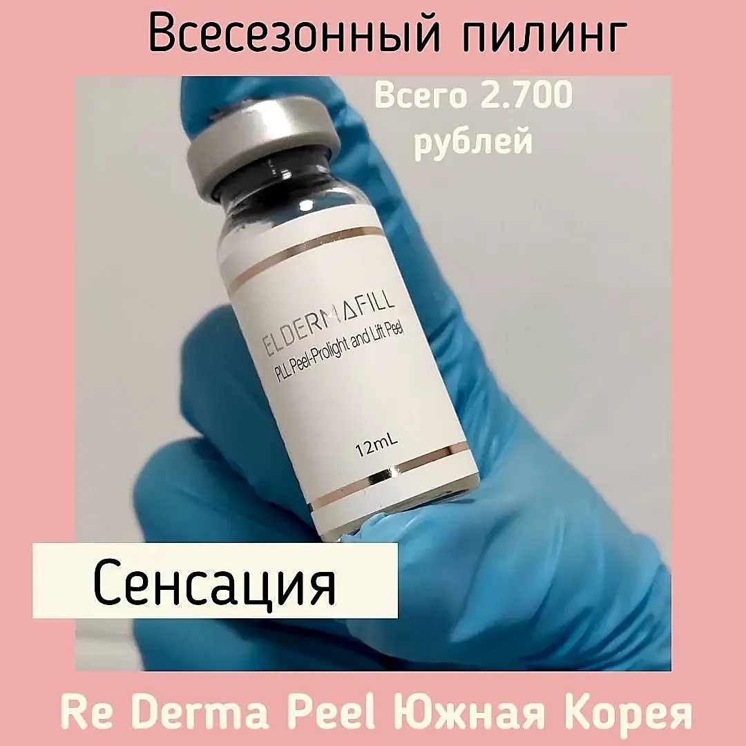 Срединный пилинг