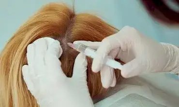 Лечение волос, трихология Лечение волос, трихология