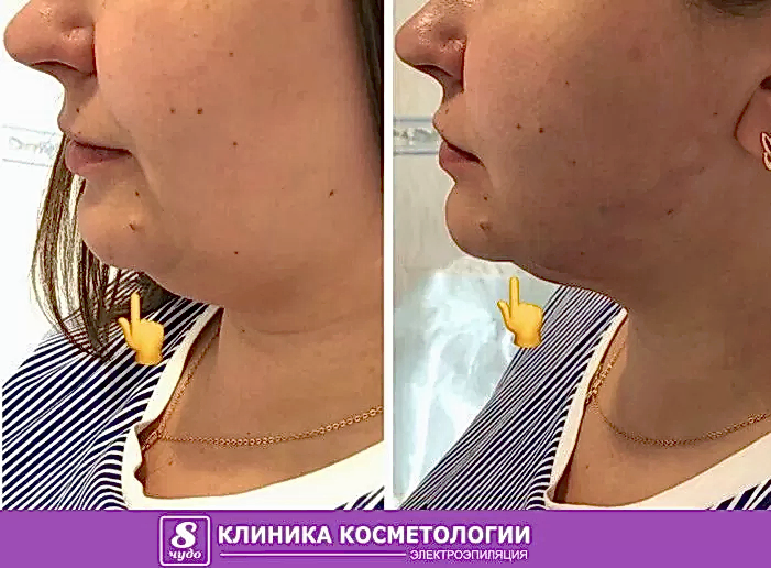 Мезонити 04.jpg Мезонити 04.jpg