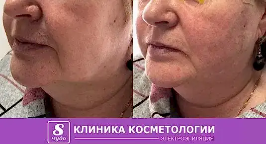 Мезонити 01.jpg Мезонити 01.jpg