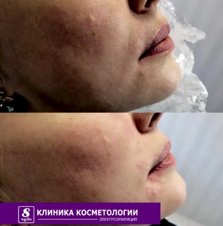 Контурная пластика 01.jpg Контурная пластика 01.jpg