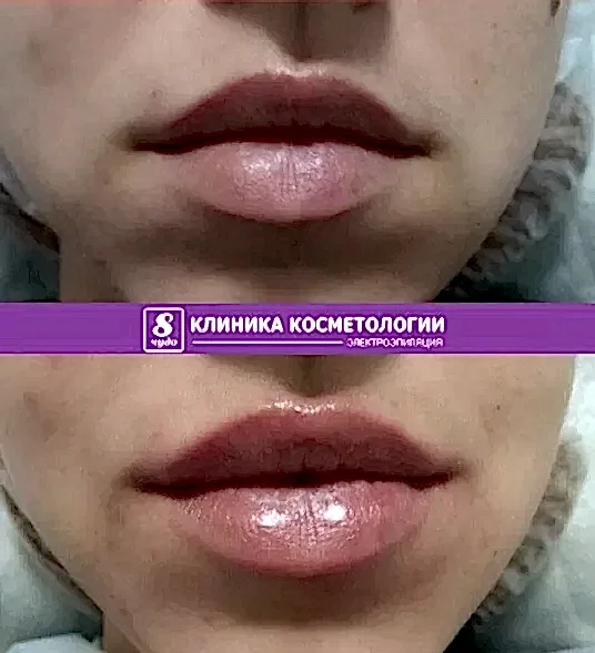 ГУБЫ 050.jpg ГУБЫ 050.jpg