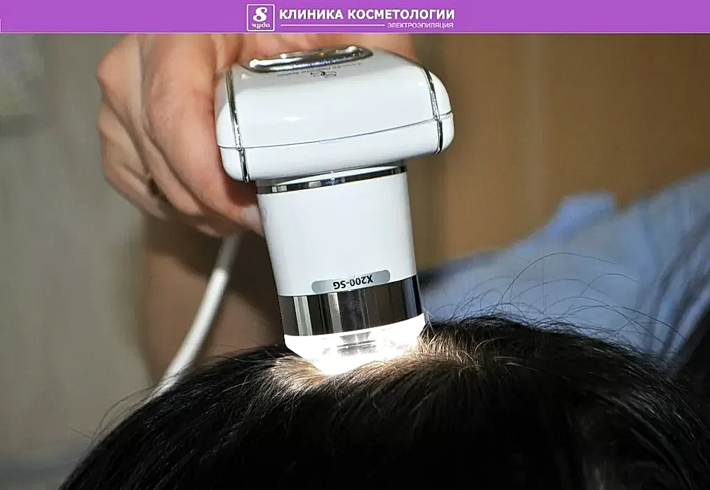 3D диагностика волосистой кожи головы 02.jpg 3D диагностика волосистой кожи головы 02.jpg