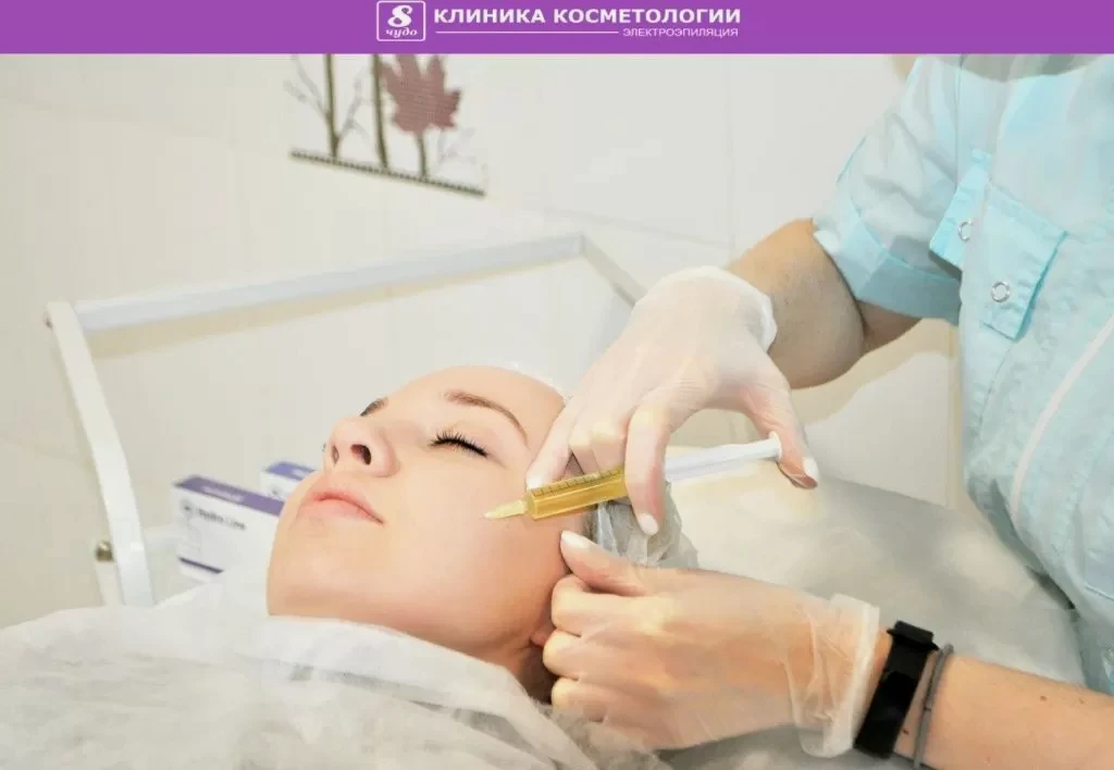 Плазмолифтинг лица 022.jpg
