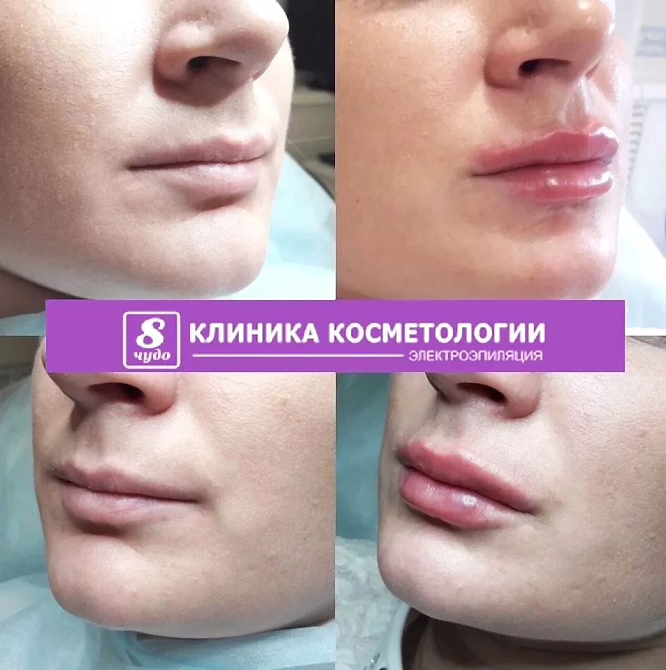 губы фил1.jpg губы фил1.jpg