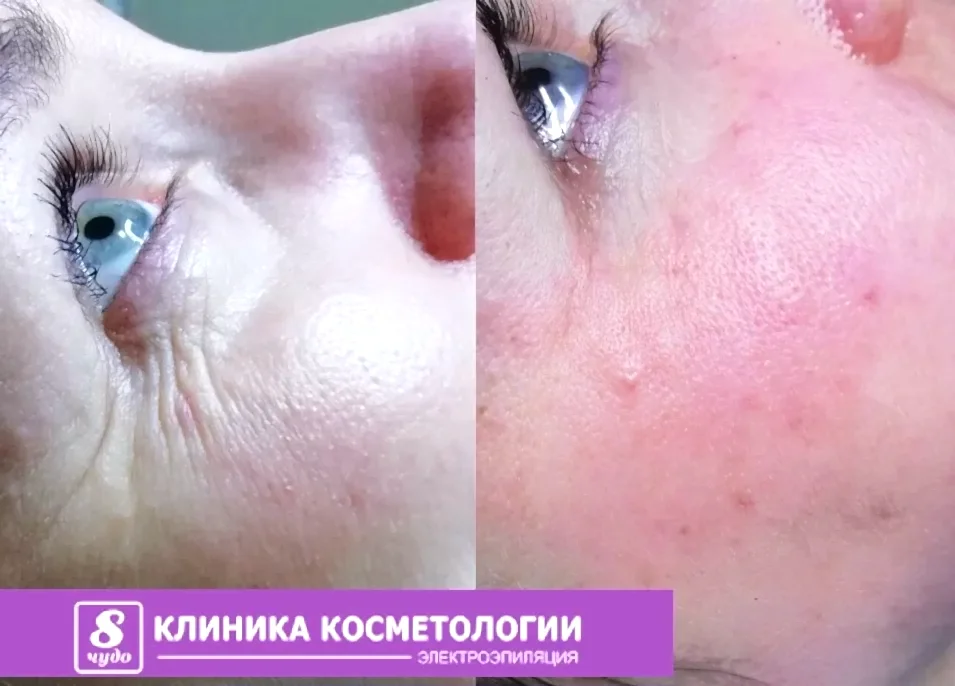 Контурная пластика 01044.jpg Контурная пластика 01044.jpg