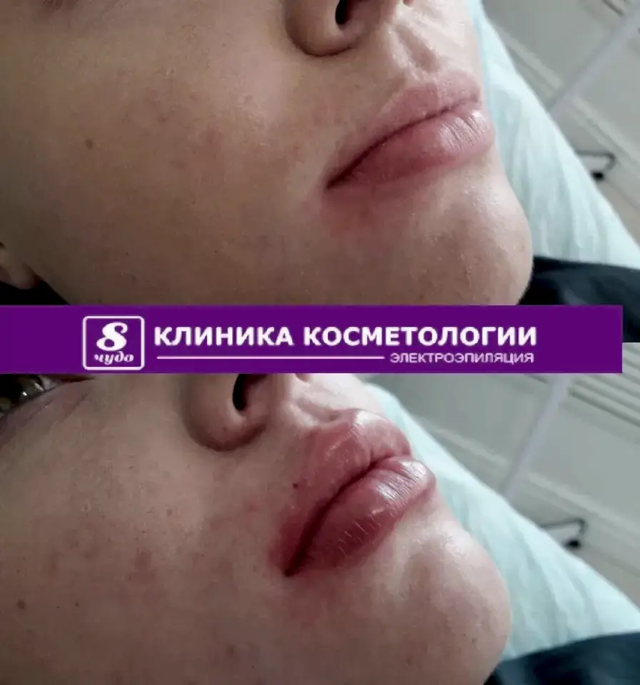 губы фил.jpg губы фил.jpg