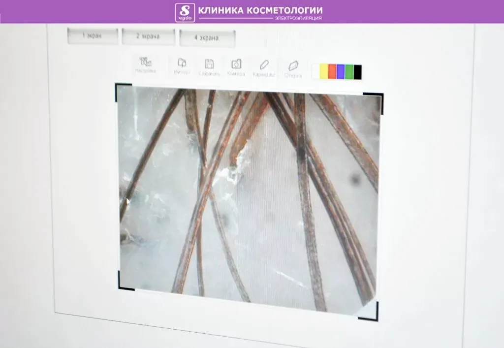 3D диагностика волосистой кожи головы 01.jpg 3D диагностика волосистой кожи головы 01.jpg