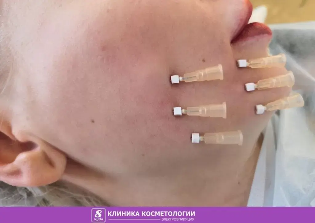 Мезонити 02.jpg Мезонити 02.jpg