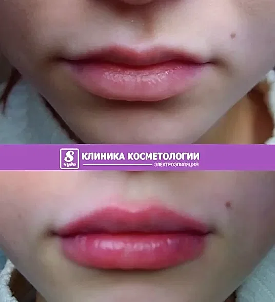 Губы 033.jpg Губы 033.jpg